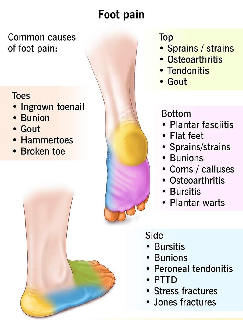 General foot pain